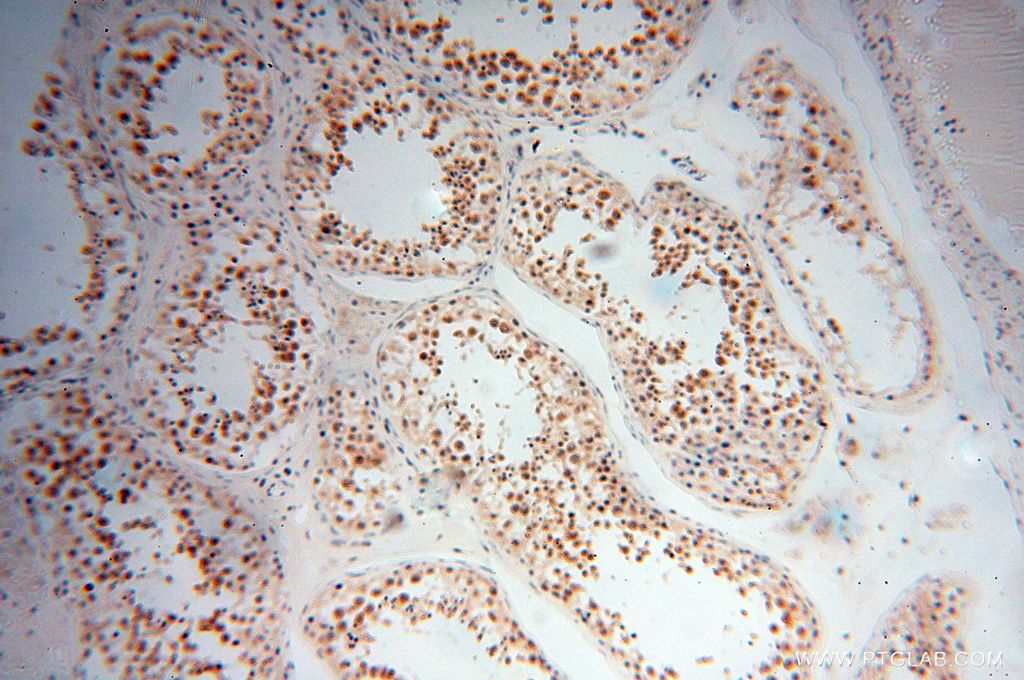 IHC staining of human testis using 17494-1-AP