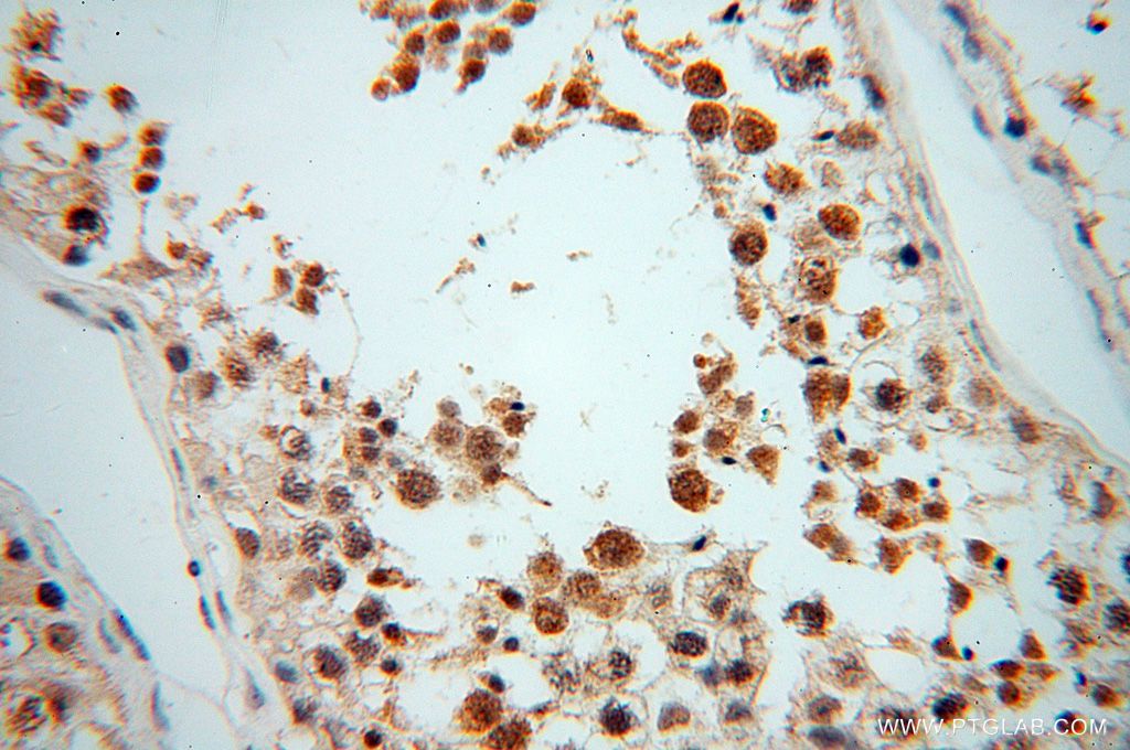 IHC staining of human testis using 17494-1-AP