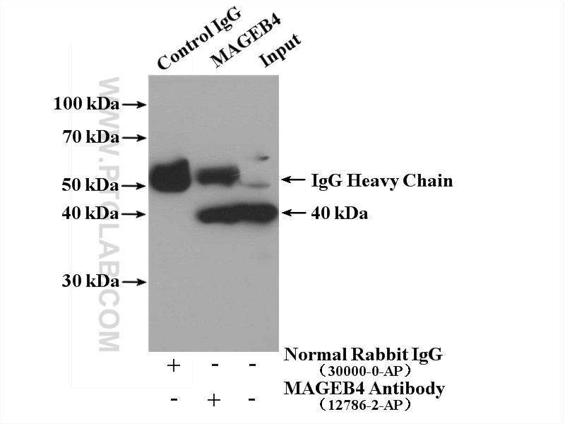 IP experiment of K-562 using 12786-2-AP