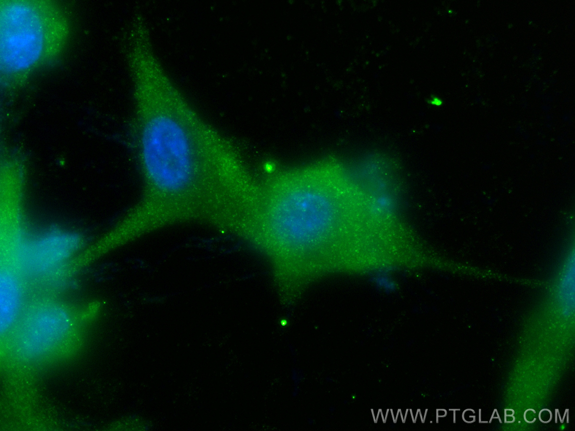 IF Staining of U-87 MG using 25189-1-AP