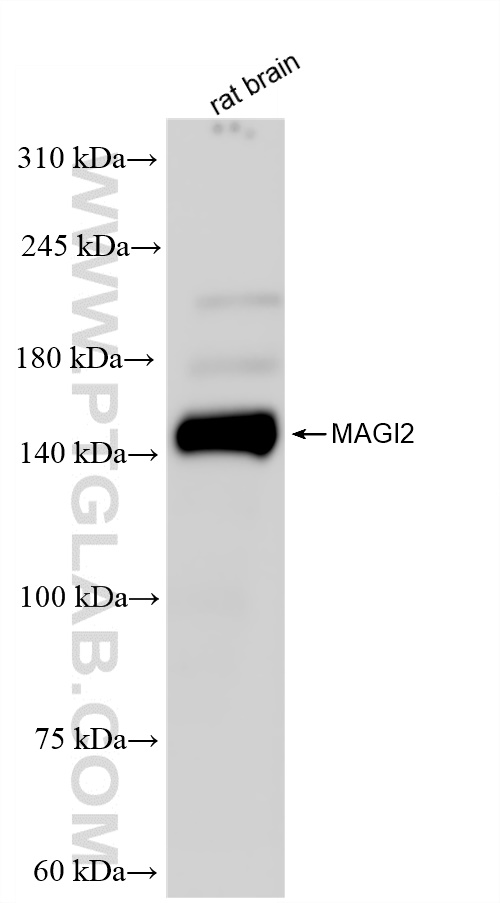 WB analysis of rat brain using 83561-6-RR