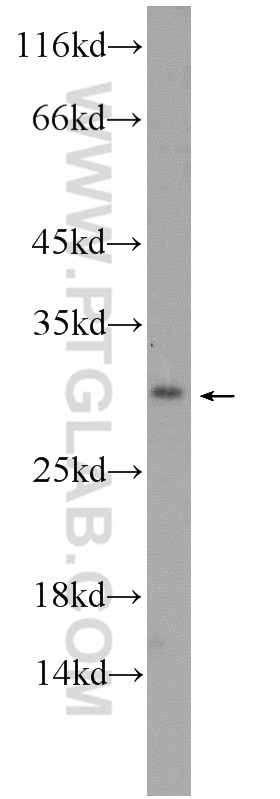 WB analysis of mouse testis using 24518-1-AP