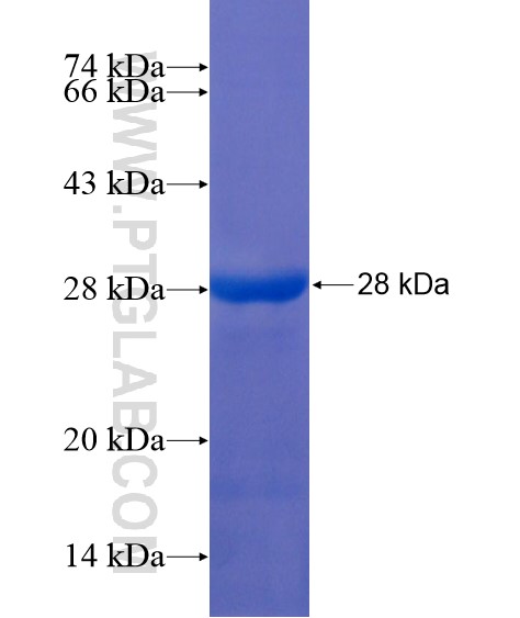 MAGIX fusion protein Ag21708 SDS-PAGE