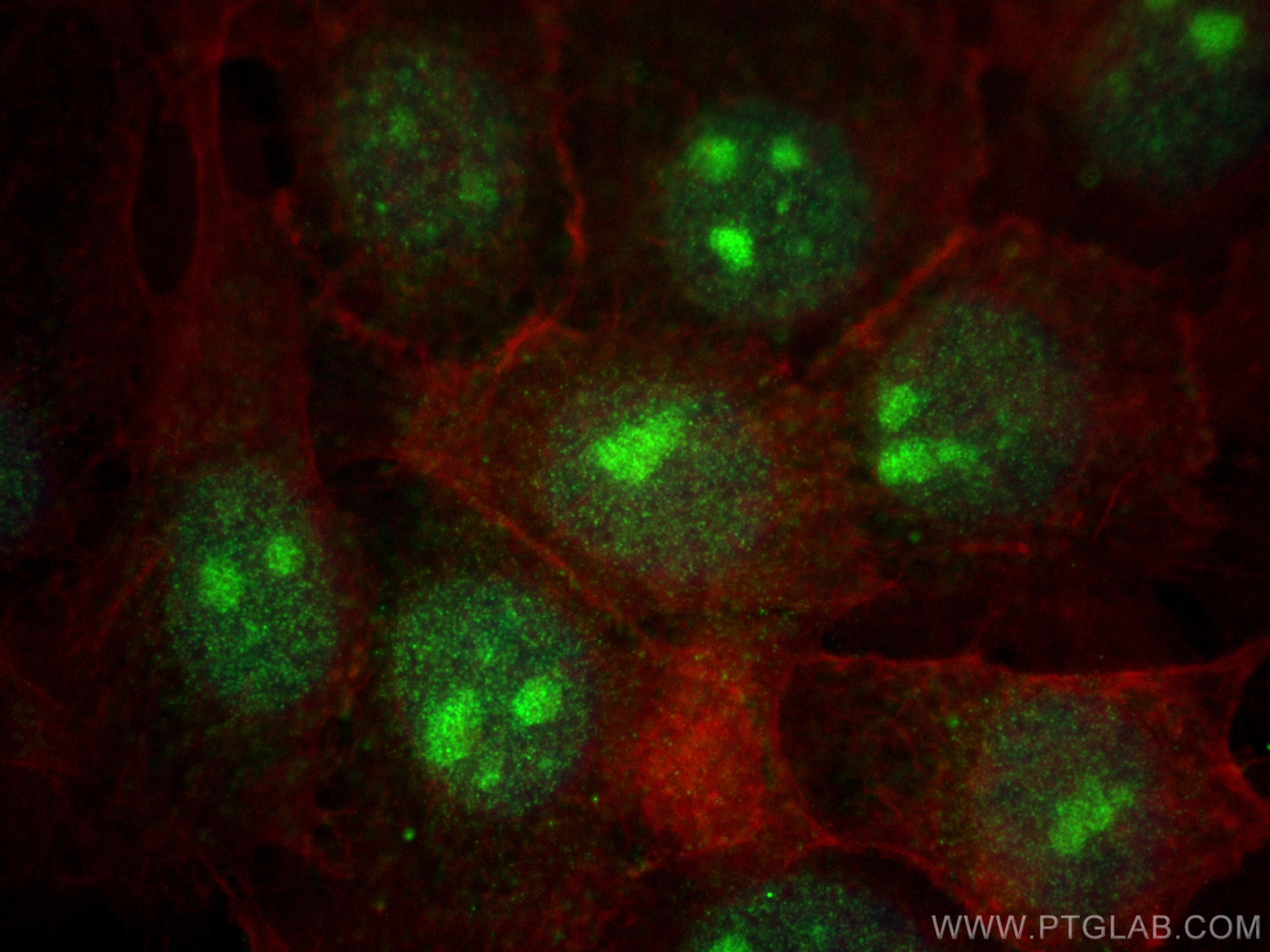 IF Staining of A431 using 17505-1-AP