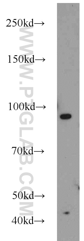 WB analysis of HeLa using 11660-1-AP