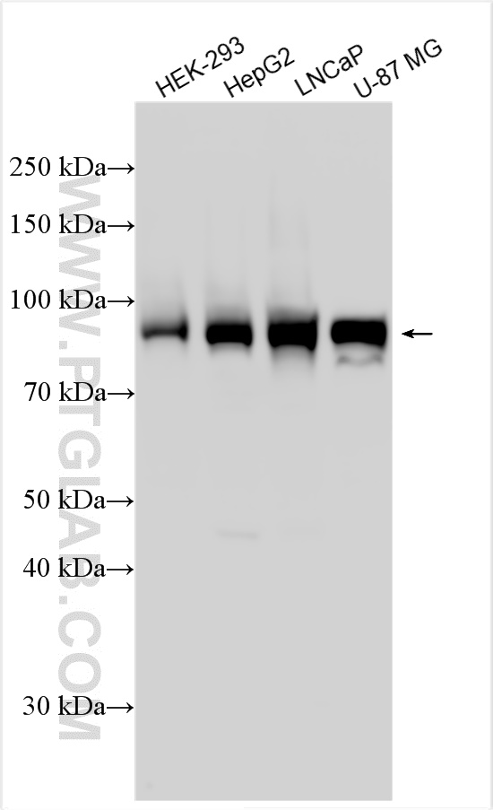 WB analysis using 15243-1-AP