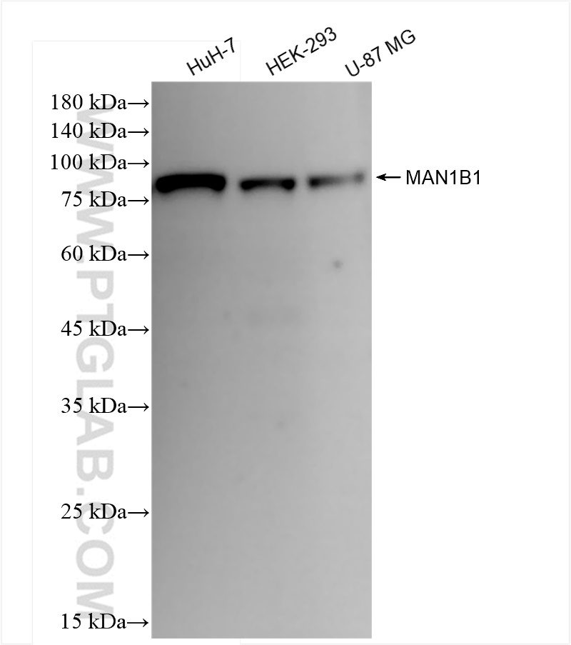 WB analysis using 84588-1-RR (same clone as 84588-1-PBS)