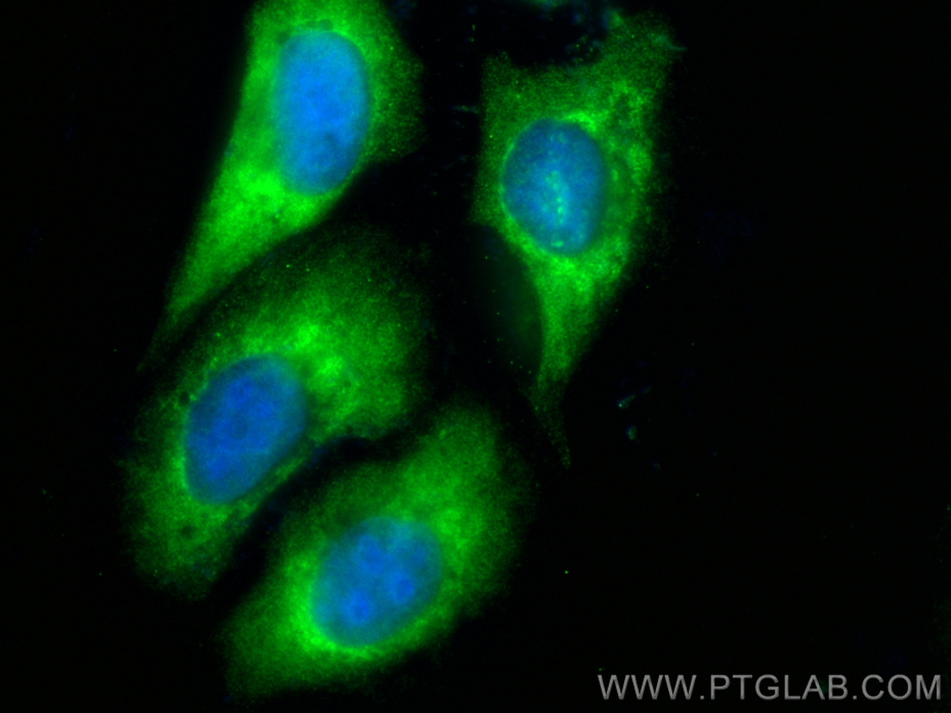 IF Staining of U2OS using CL488-68121