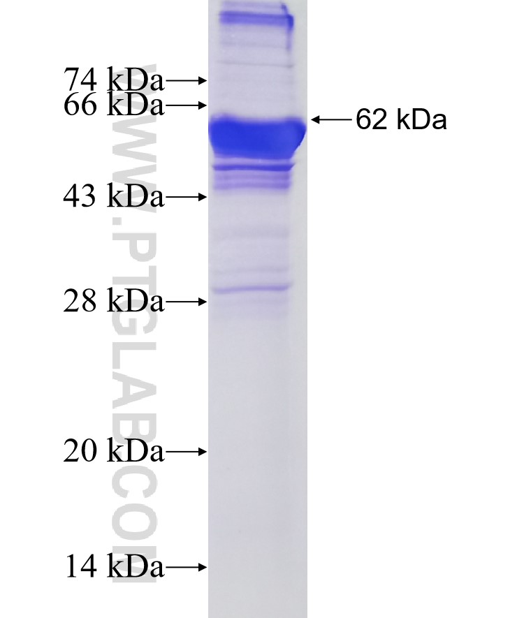 MAN1B1 fusion protein Ag7455 SDS-PAGE