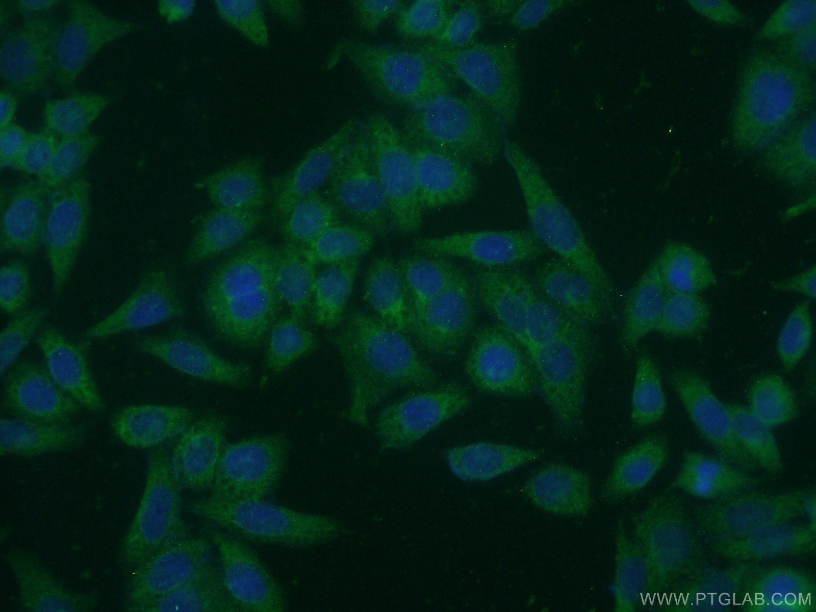 IF Staining of HeLa using 21132-1-AP (same clone as 21132-1-PBS)