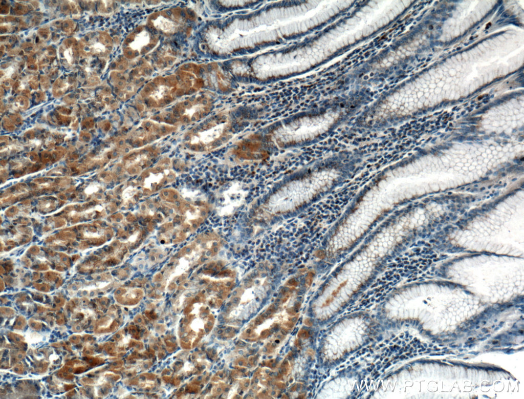 IHC staining of human stomach using 21132-1-AP (same clone as 21132-1-PBS)