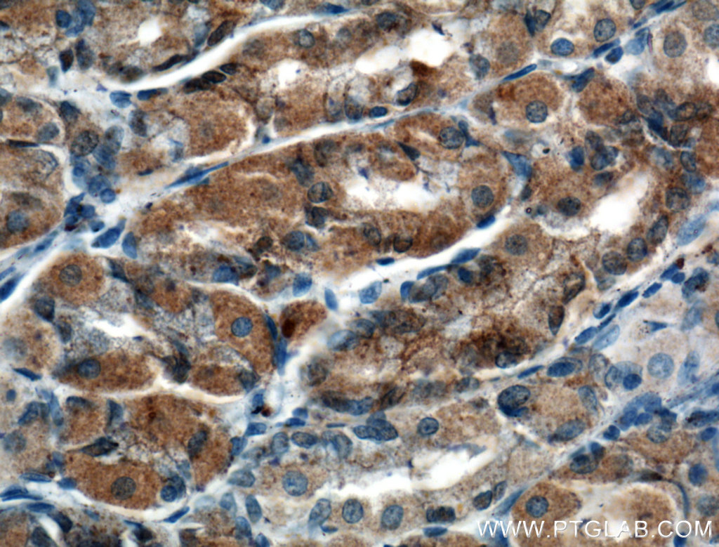 IHC staining of human stomach using 21132-1-AP (same clone as 21132-1-PBS)