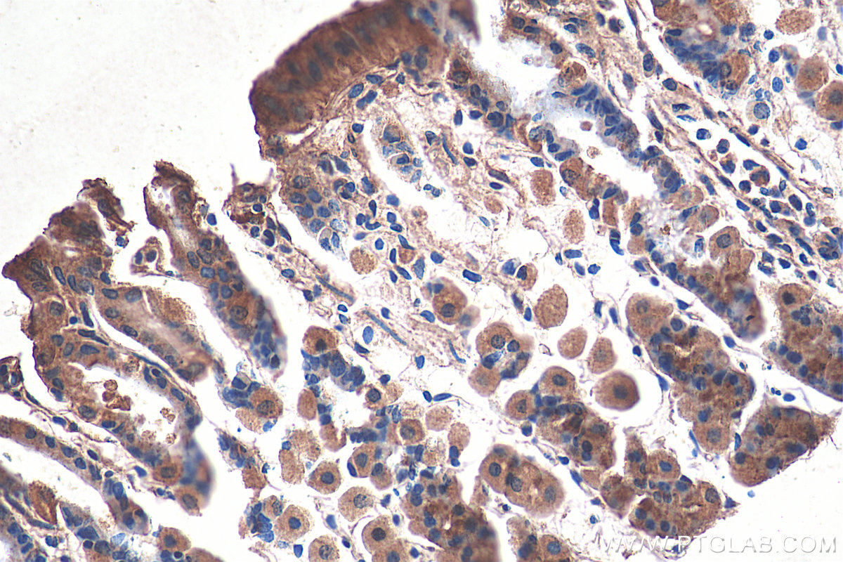 IHC staining of mouse stomach using 21132-1-AP (same clone as 21132-1-PBS)