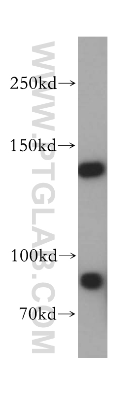 WB analysis of mouse testis using 17697-1-AP