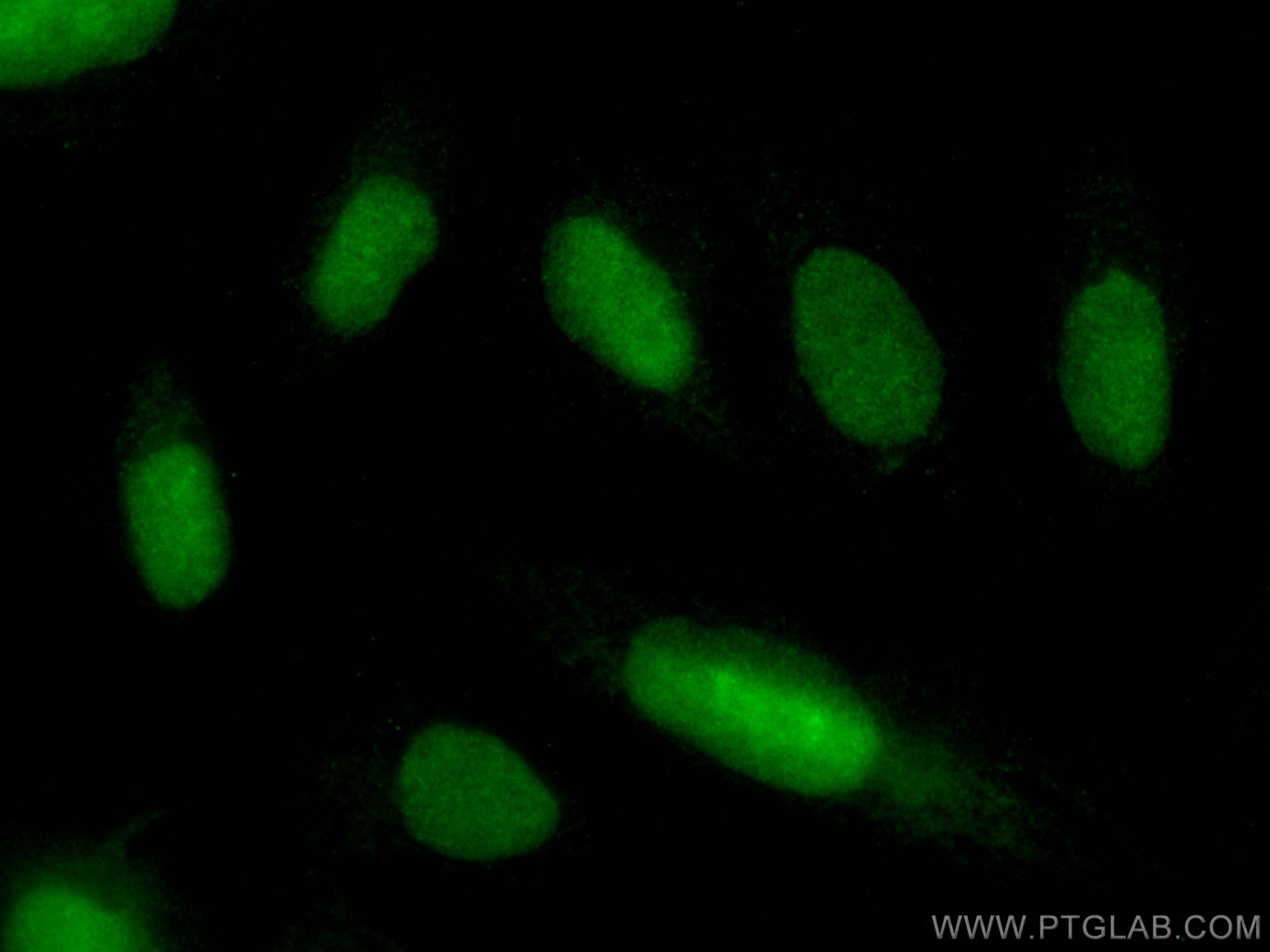 IF Staining of U2OS using 16028-1-AP