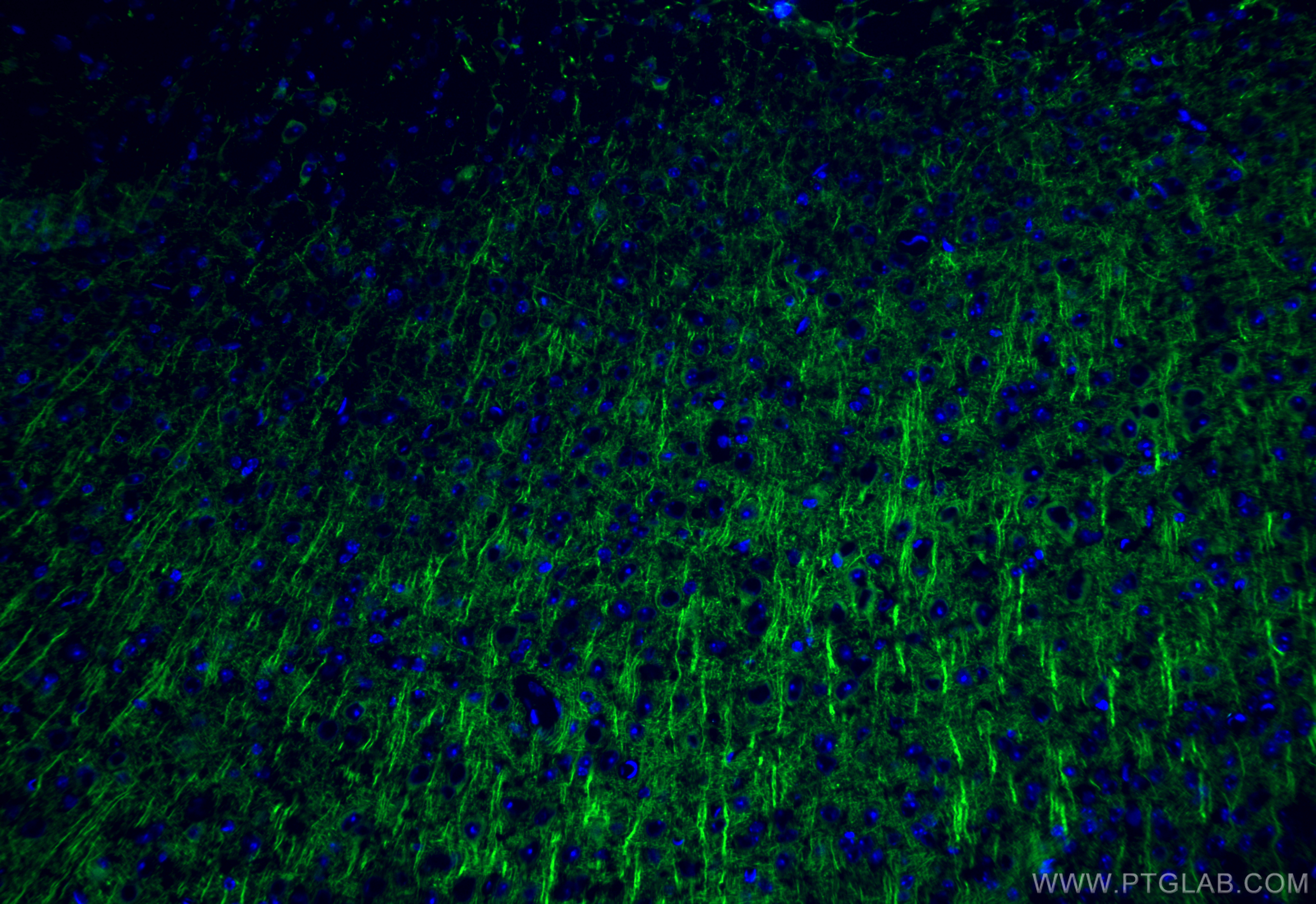 IF Staining of mouse brain using 84306-3-RR