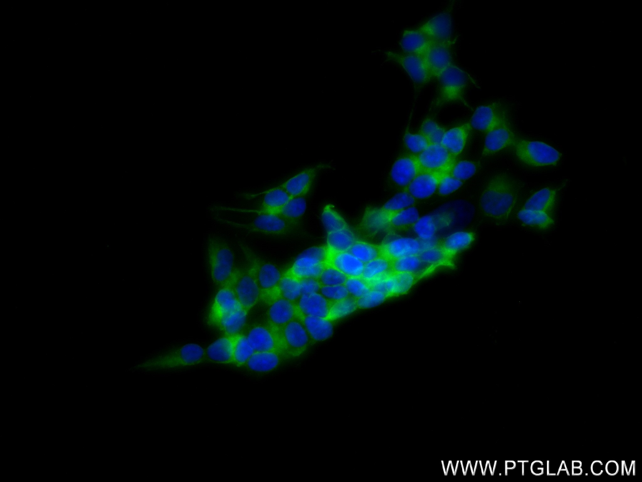 IF Staining of SH-SY5Y using 84306-4-RR