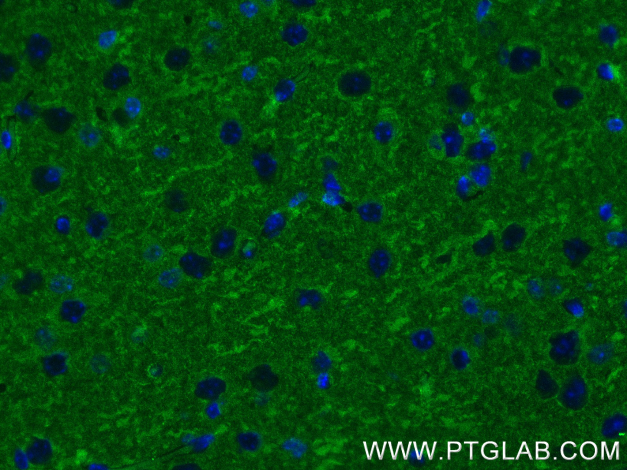 IF Staining of mouse brain using 84306-4-RR (same clone as 84306-4-PBS)