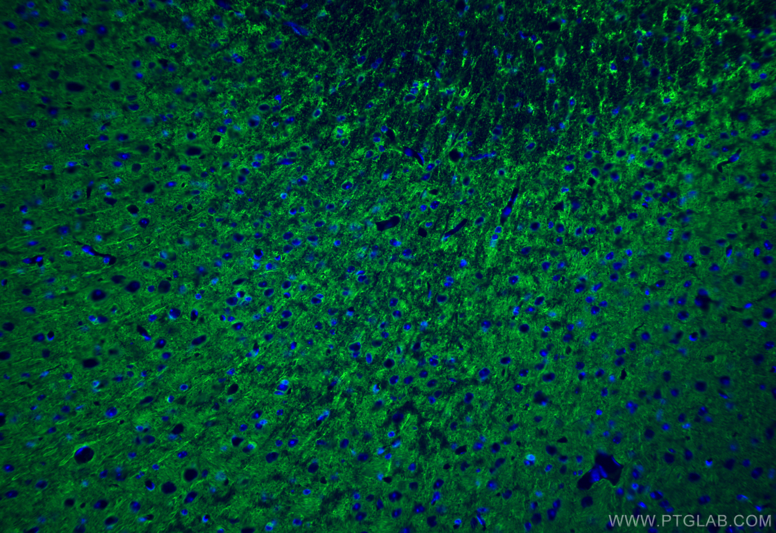 IF Staining of mouse brain using 84306-4-RR (same clone as 84306-4-PBS)