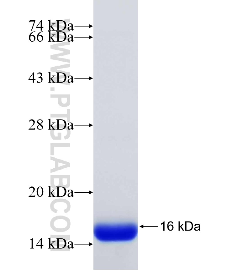 MAP2K6 fusion protein Ag31565 SDS-PAGE