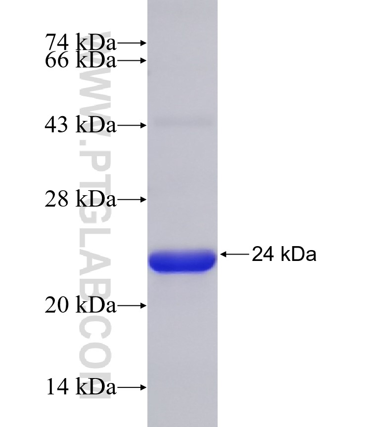 MAP3K10 fusion protein Ag31582 SDS-PAGE