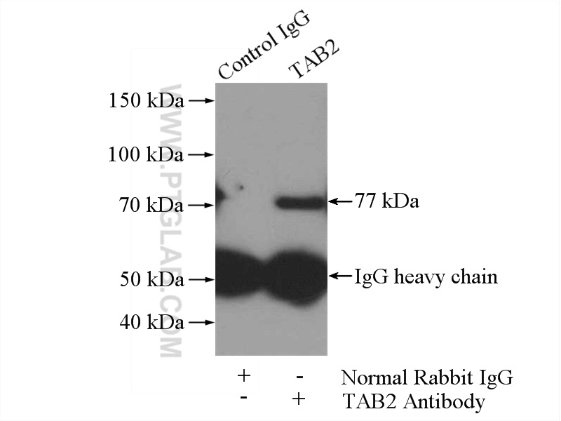 IP experiment of HepG2 using 14410-1-AP