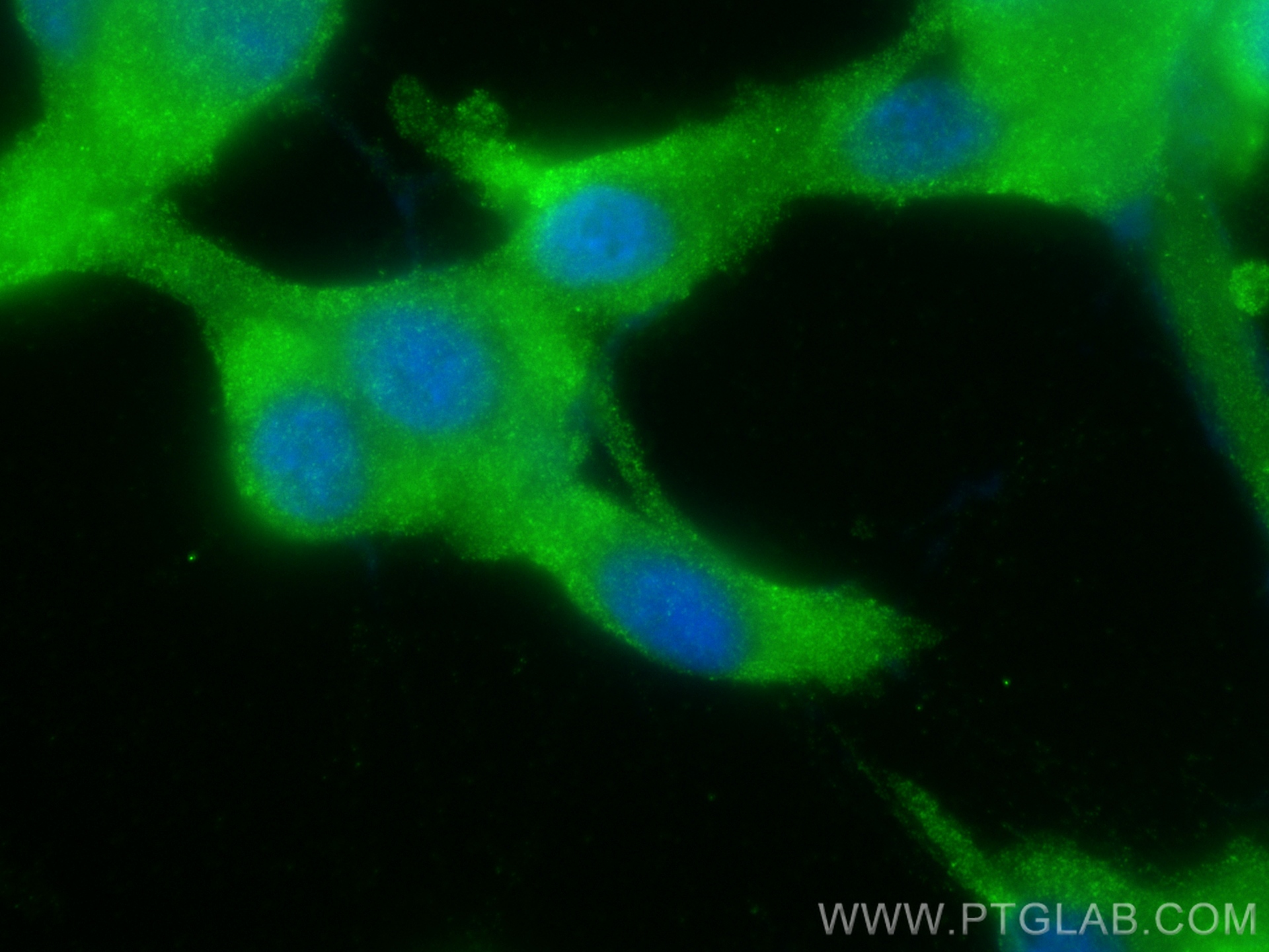 IF Staining of U-87 MG using 30716-1-AP