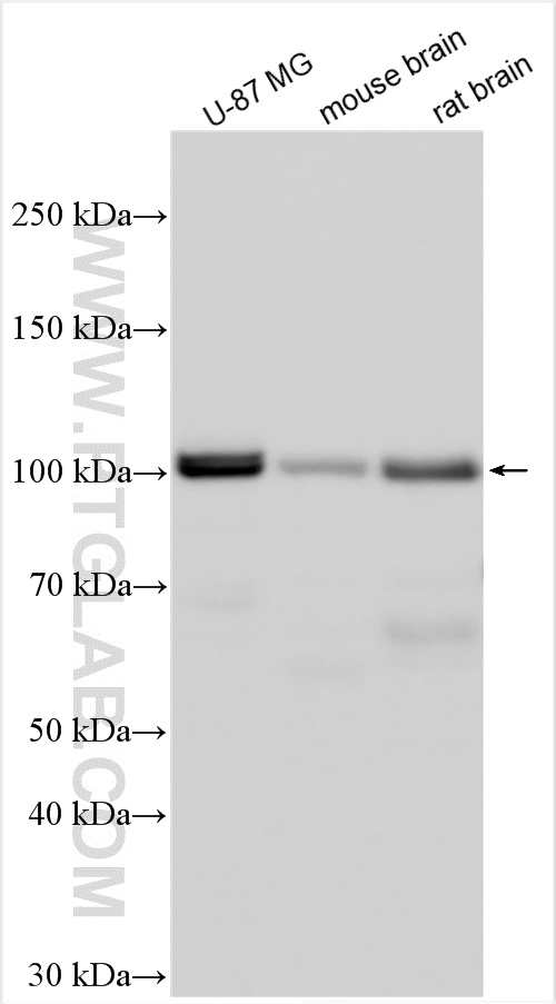 WB analysis using 30716-1-AP