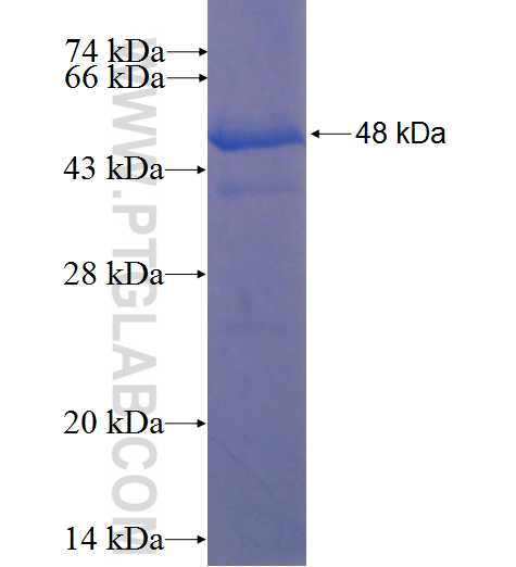 MAP6 fusion protein Ag22850 SDS-PAGE