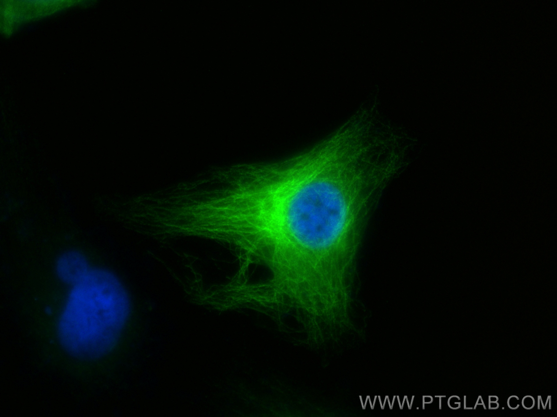 IF Staining of HeLa using 13446-1-AP