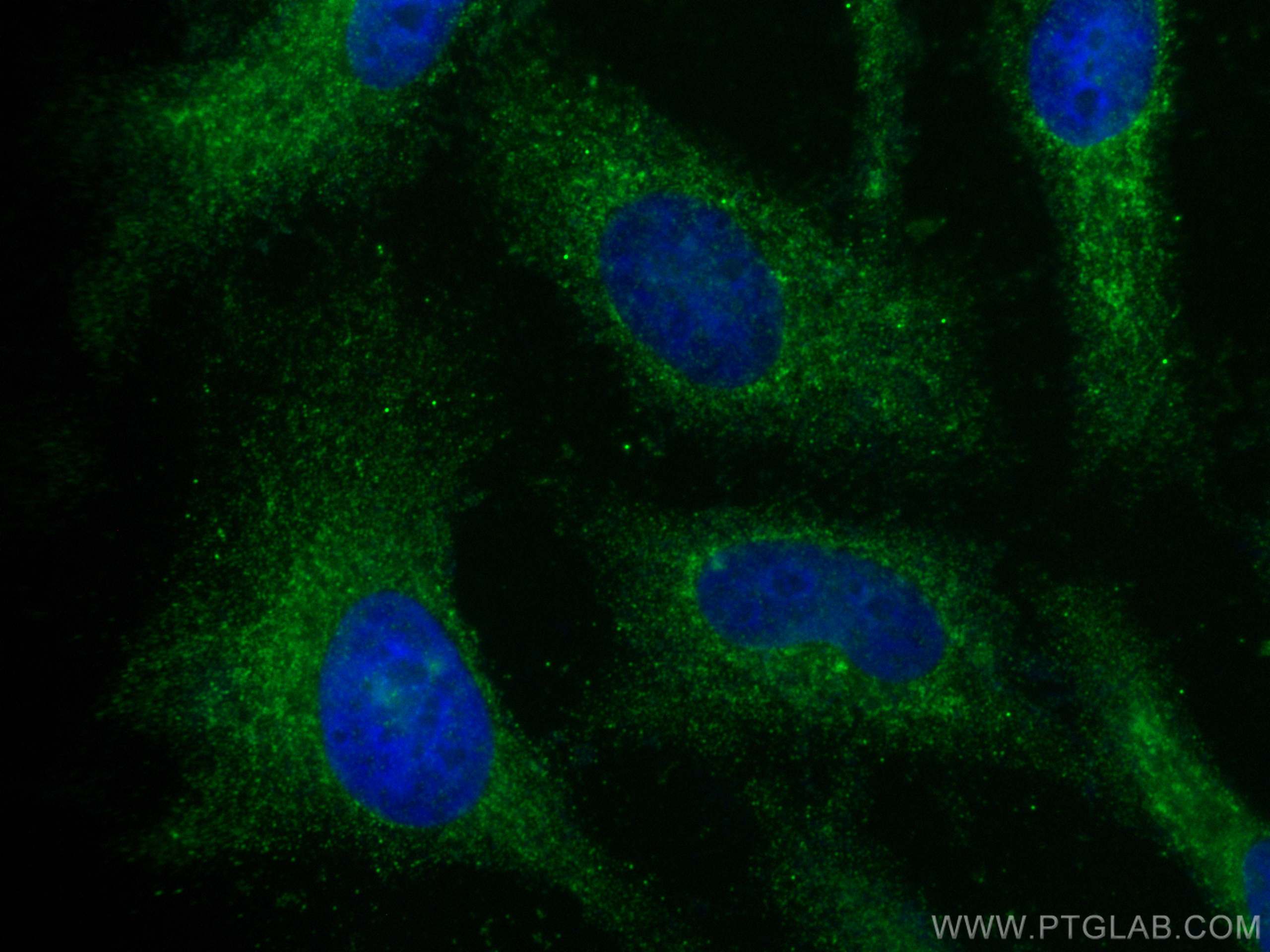 IF Staining of HeLa using 26078-1-AP