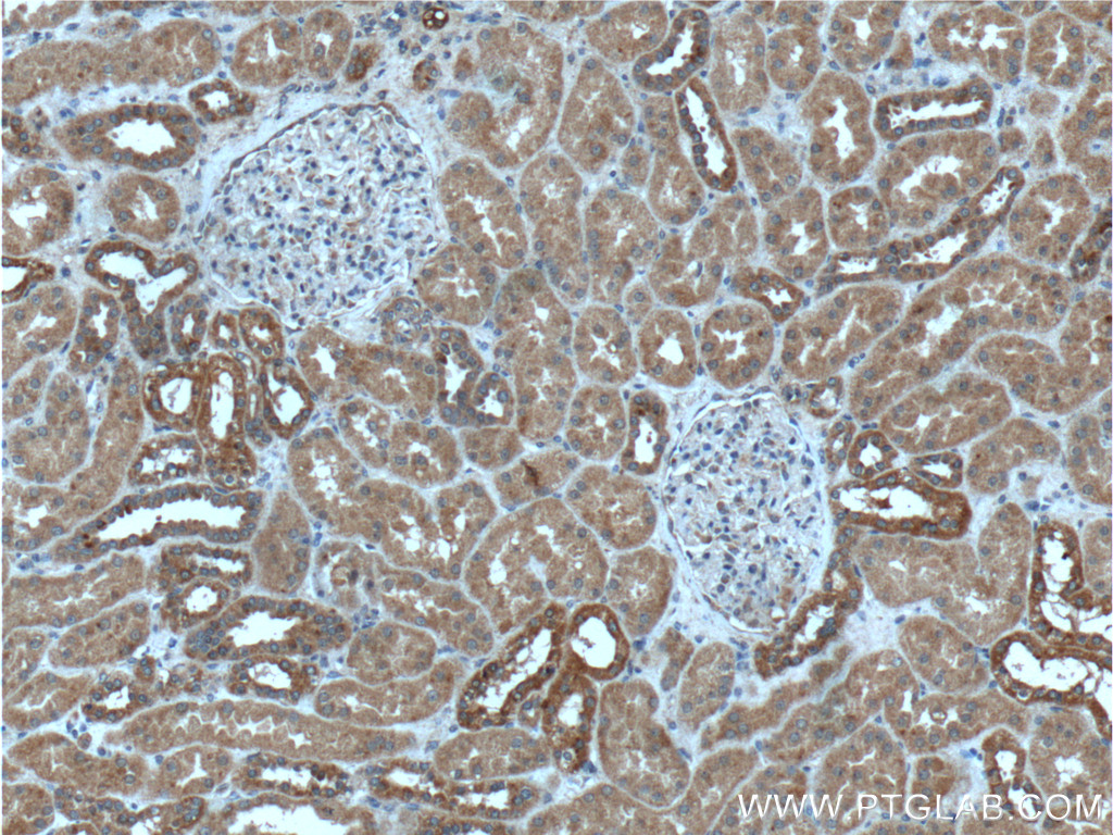 IHC staining of human kidney using 13452-1-AP