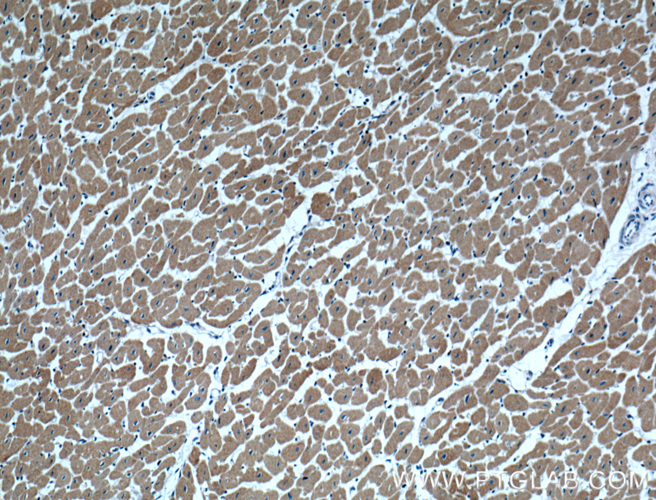 IHC staining of human heart using 18738-1-AP