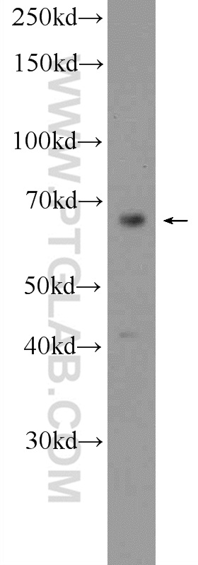 WB analysis of mouse brain using 18738-1-AP