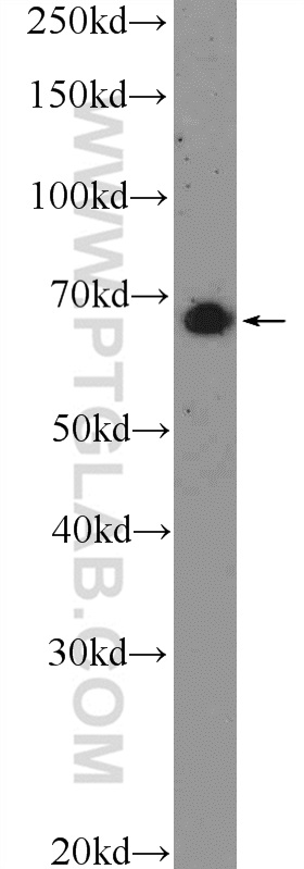 WB analysis of mouse brain using 26102-1-AP