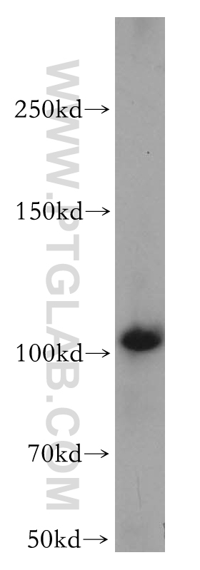 WB analysis of A431 using 12839-1-AP