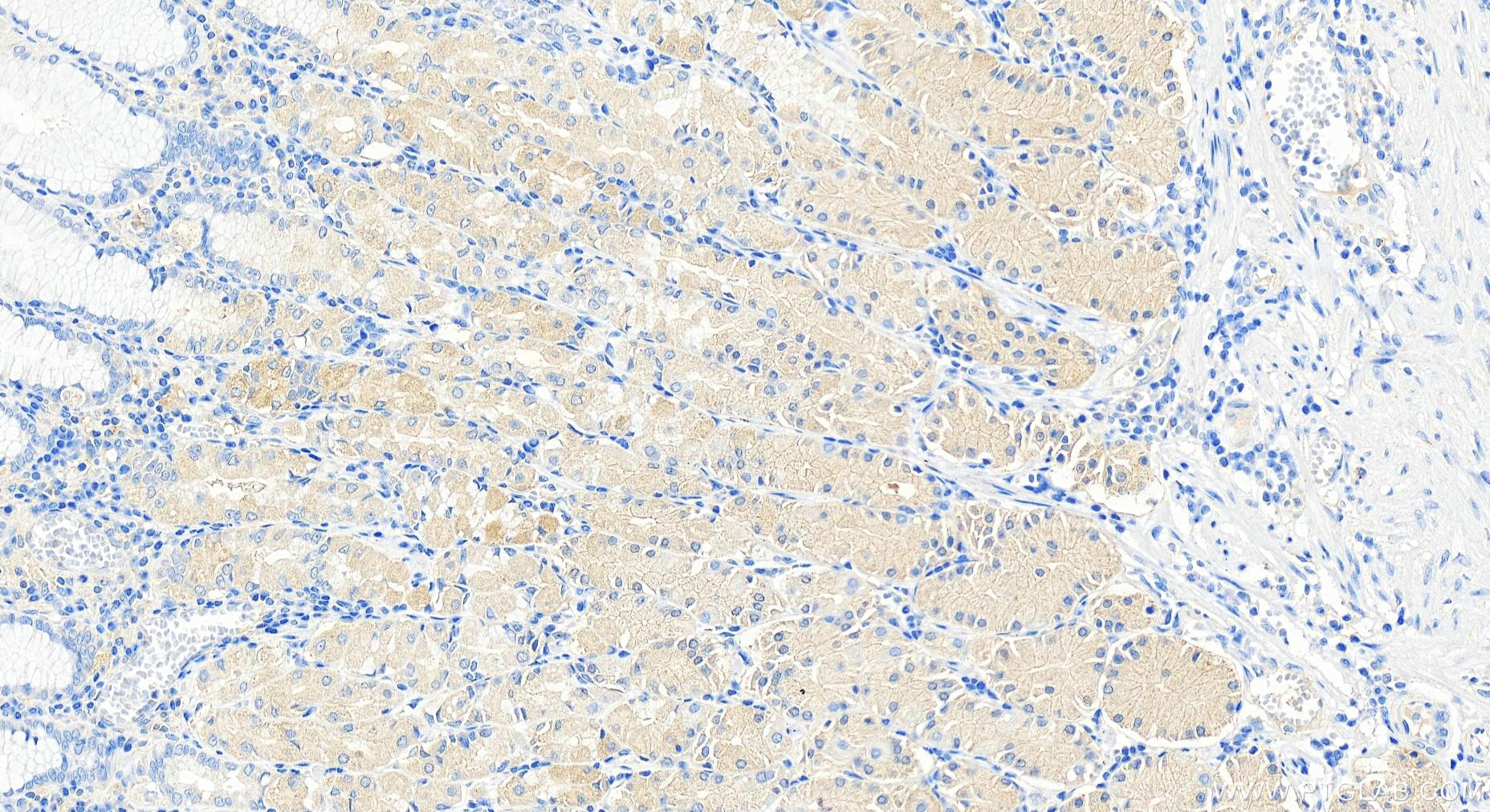 IHC staining of human stomach using 11164-1-AP