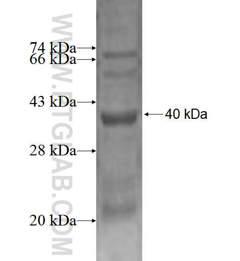 MAPKSP1 fusion protein Ag2534 SDS-PAGE