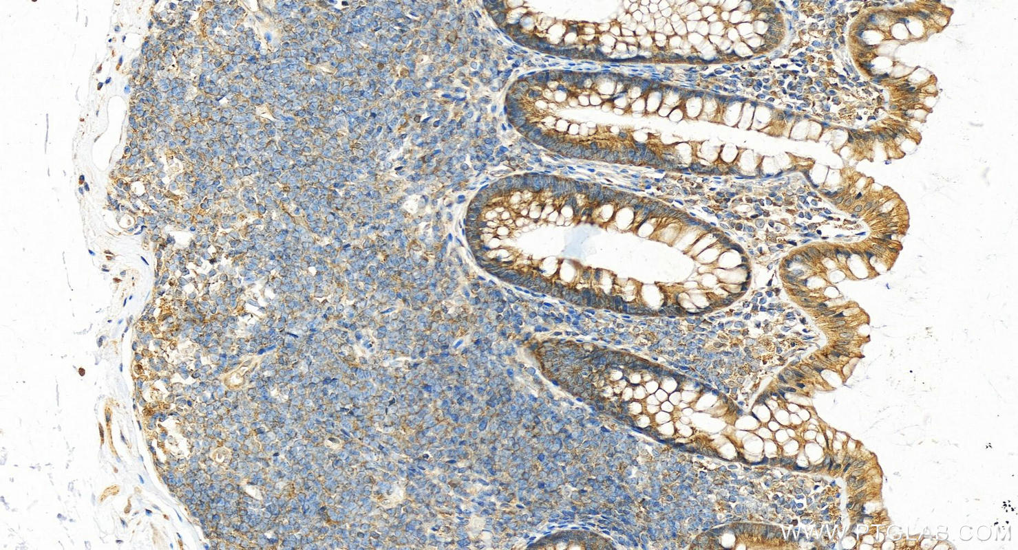 IHC staining of human colon using 17717-1-AP