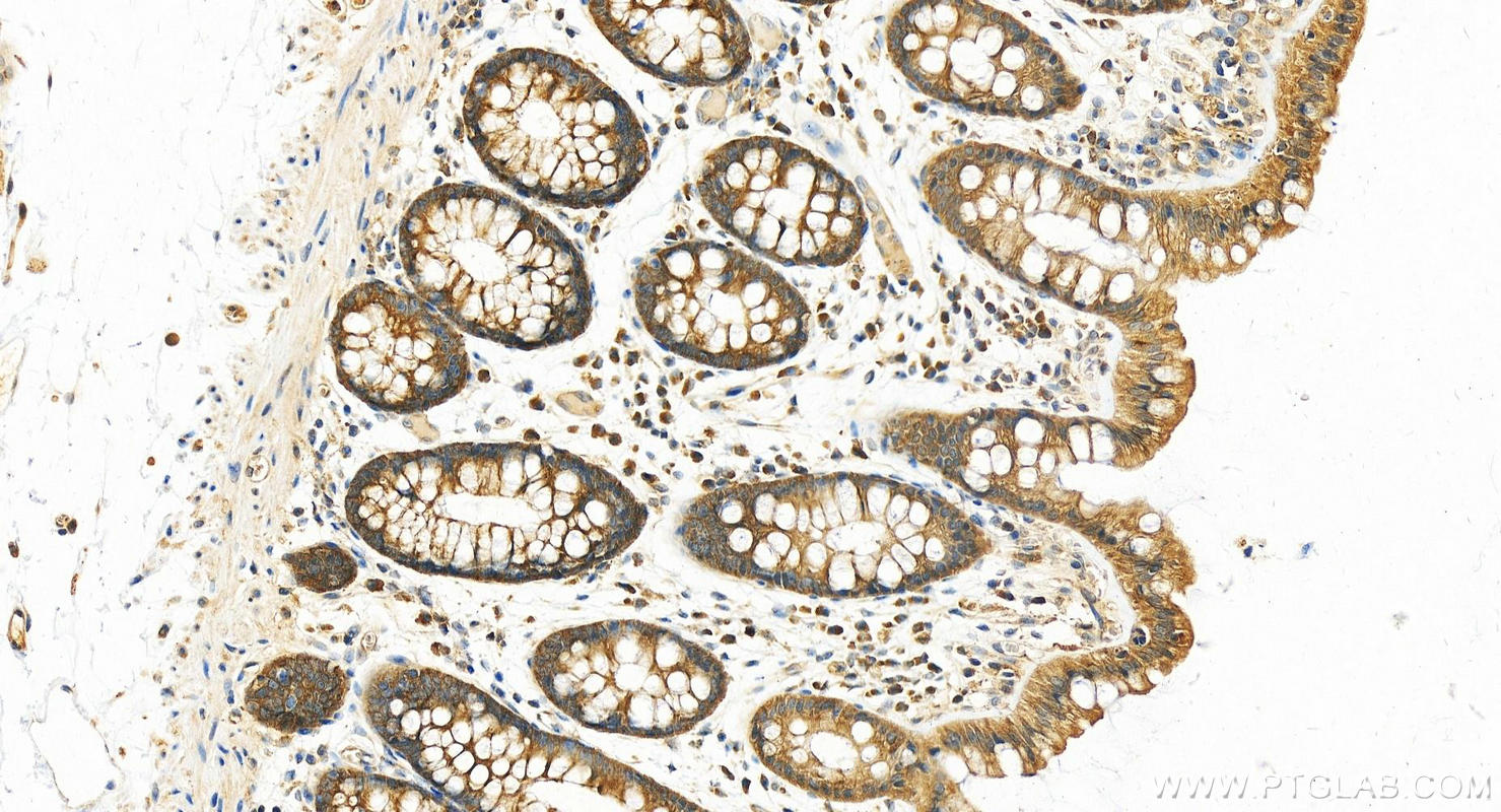 IHC staining of human colon using 17717-1-AP