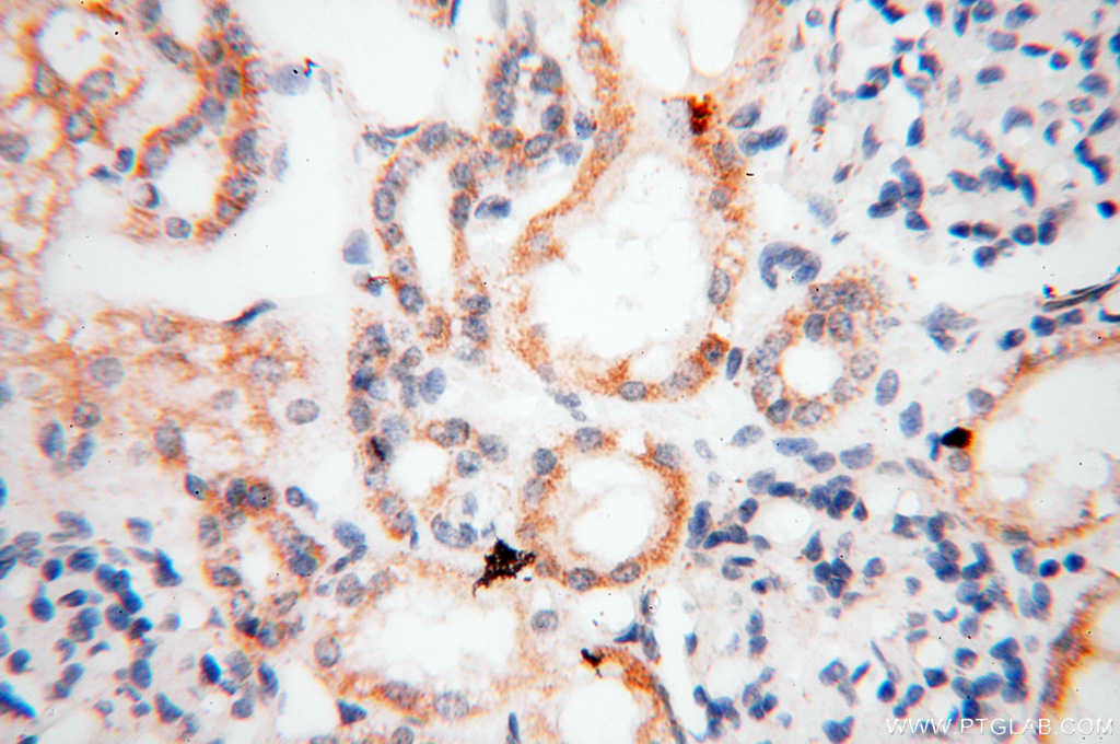 IHC staining of human kidney using 17717-1-AP