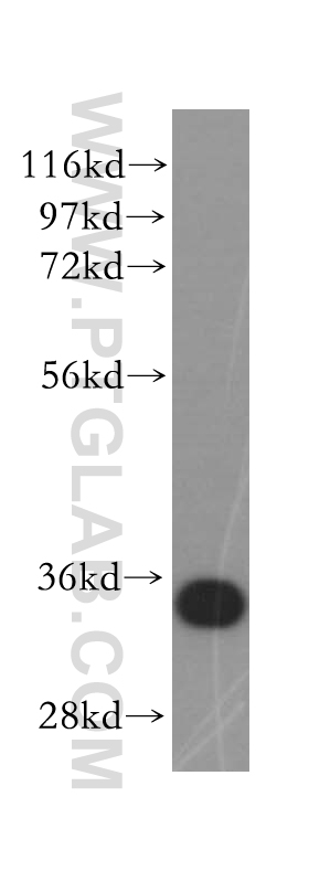 WB analysis of HeLa using 17717-1-AP