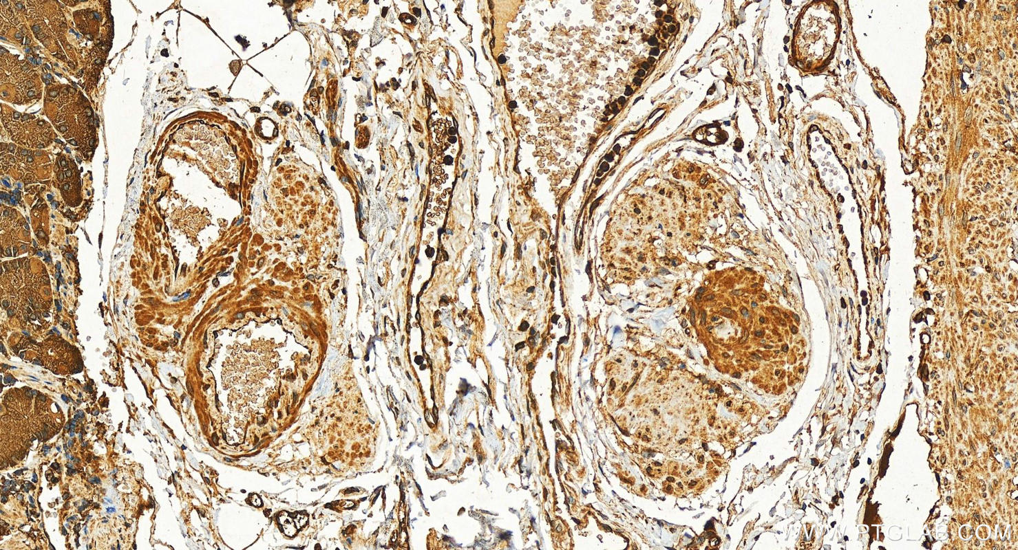 IHC staining of human stomach using 10364-1-AP