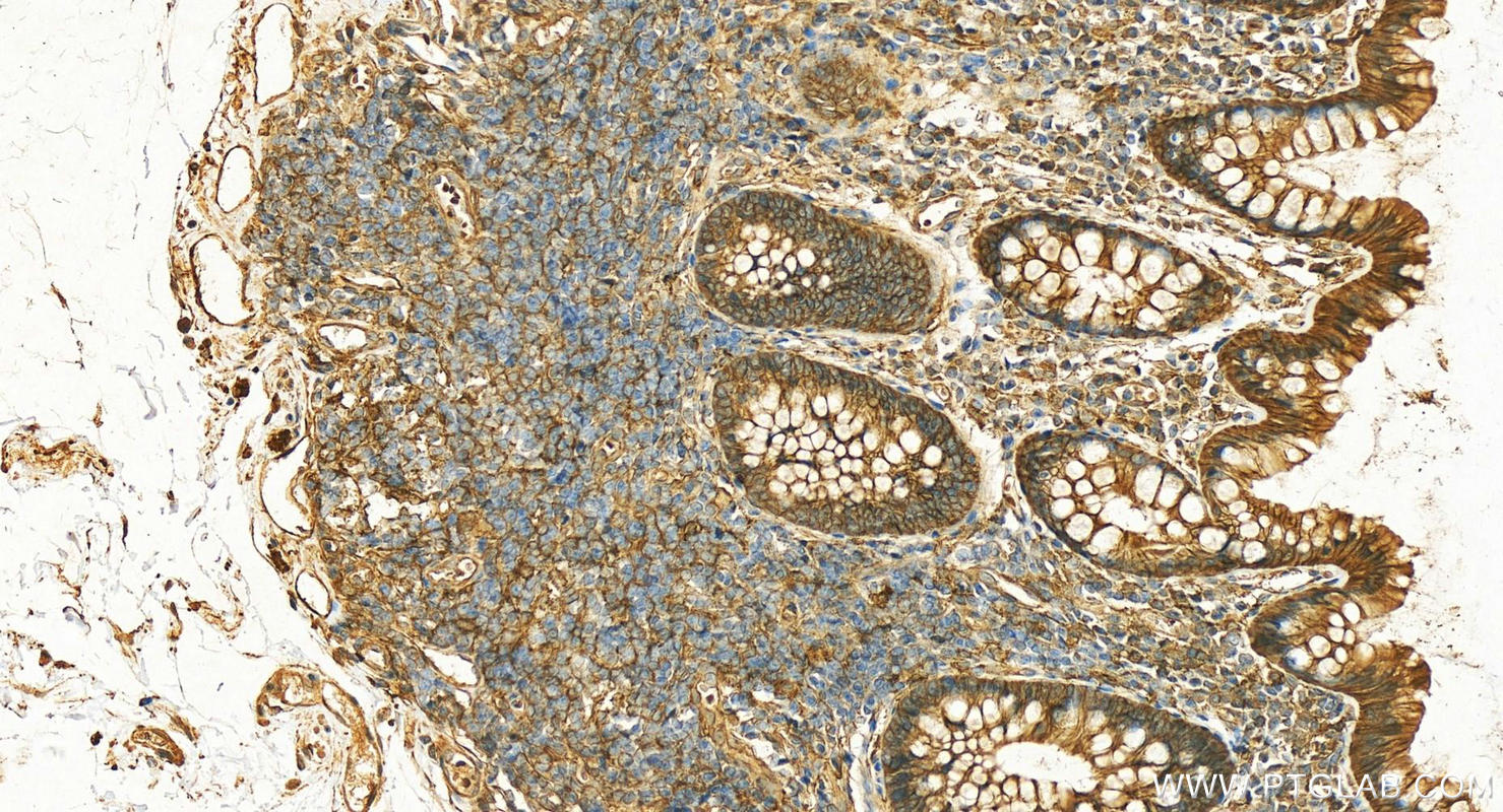 IHC staining of human normal colon using 20661-1-AP