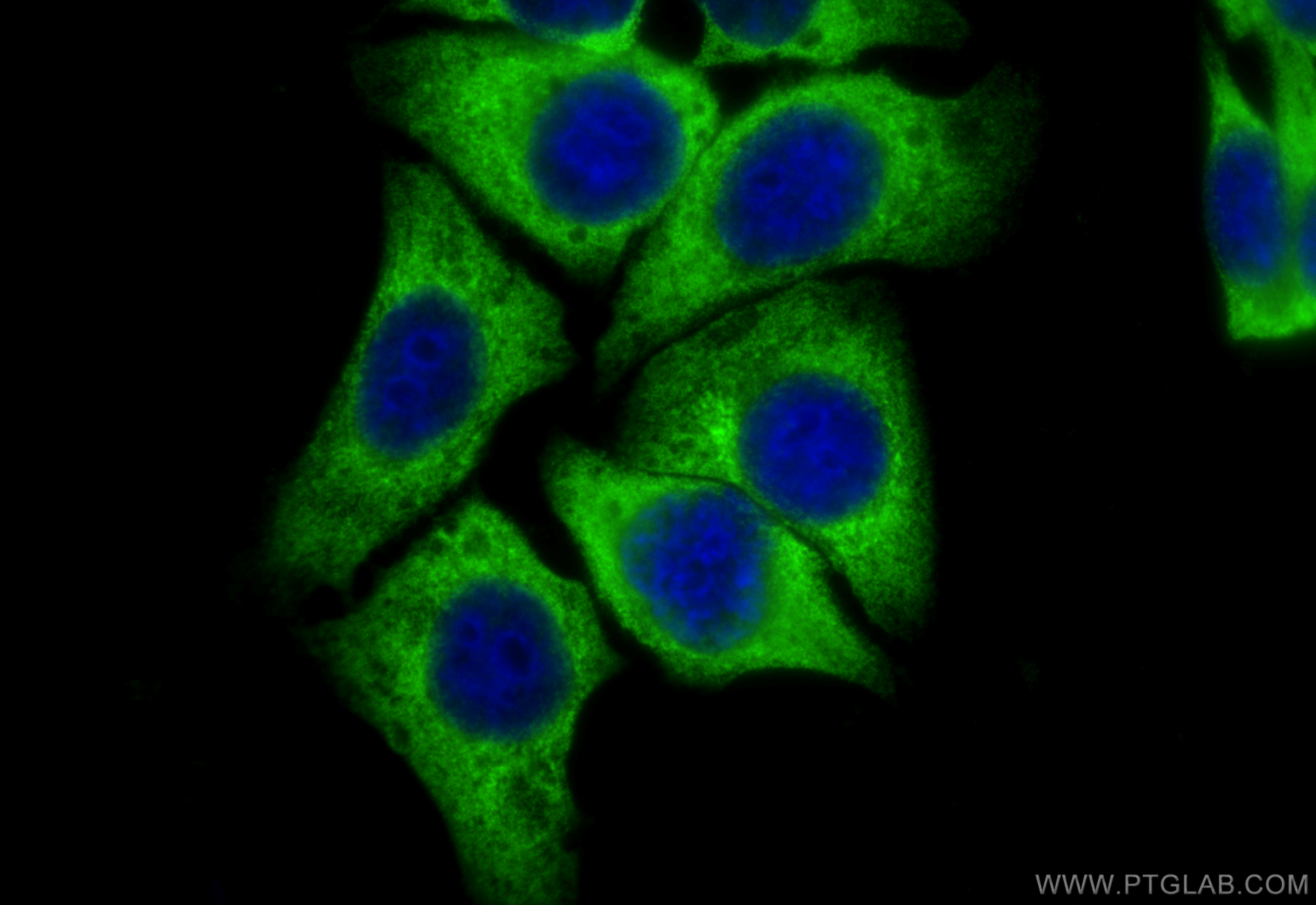 IF Staining of HepG2 using 14829-1-AP