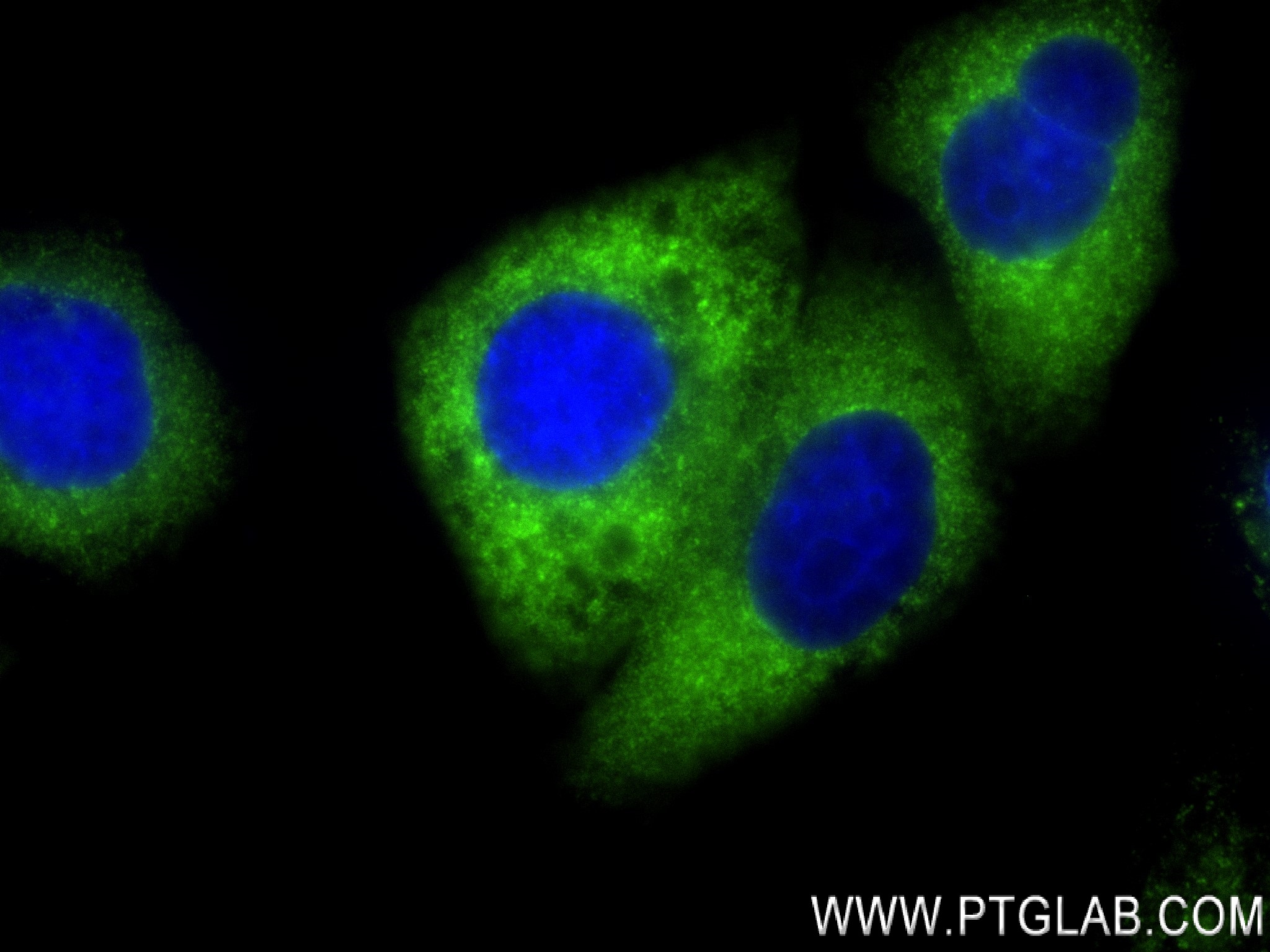 IF Staining of HepG2 using 83690-4-RR (same clone as 83690-4-PBS)