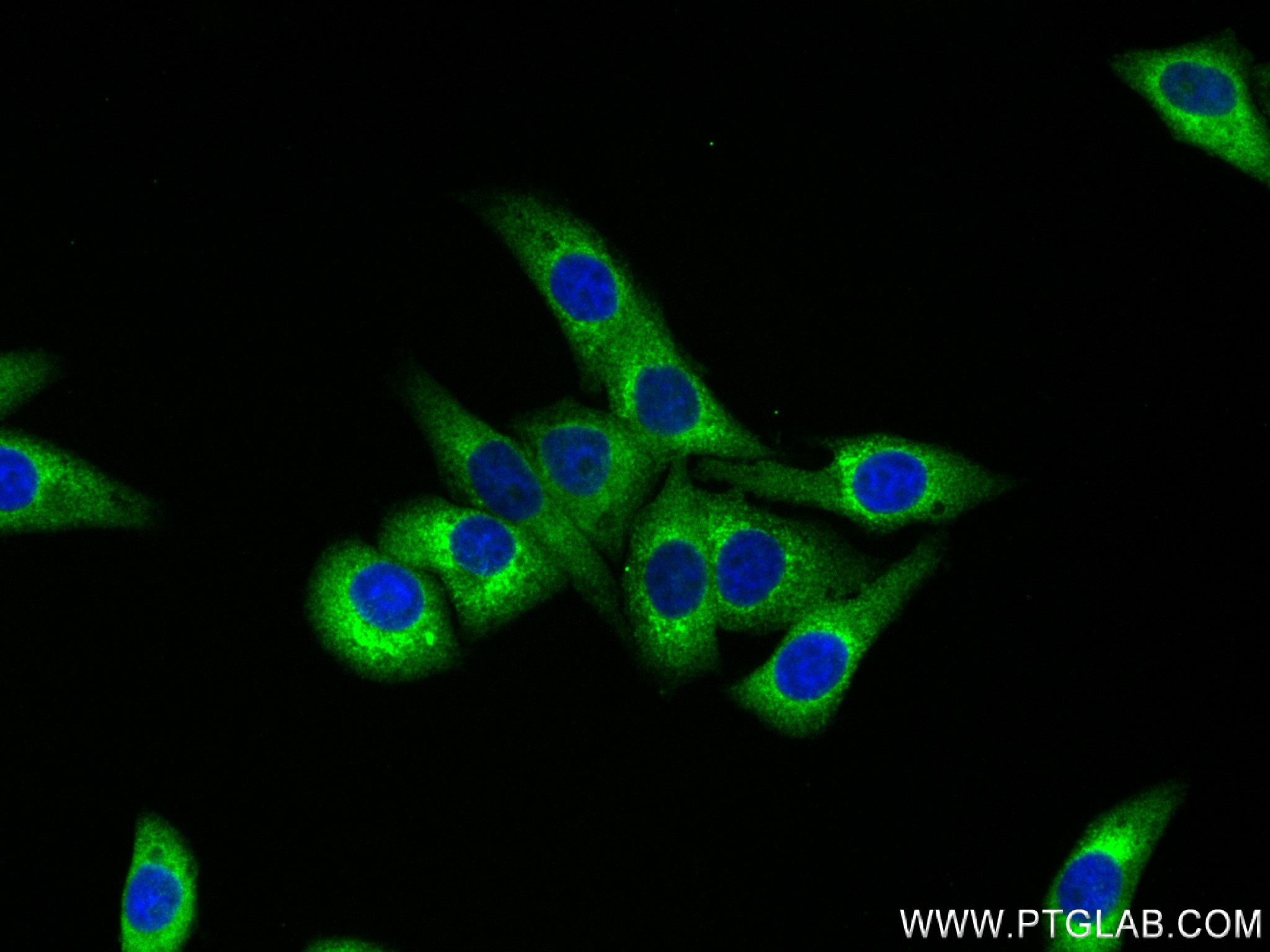 IF Staining of HepG2 using 83690-5-RR