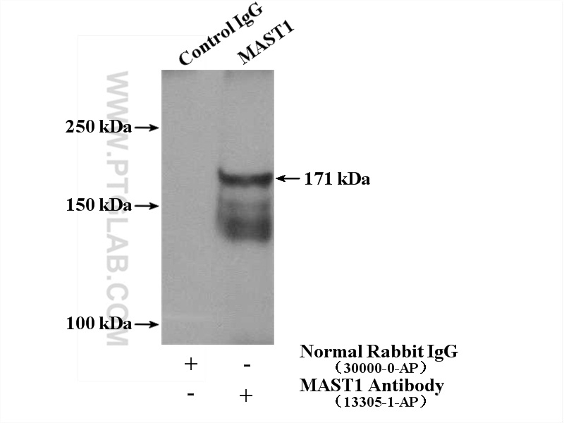 IP experiment of mouse brain using 13305-1-AP