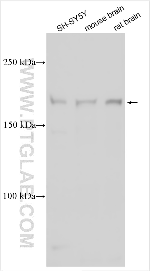 WB analysis using 13305-1-AP