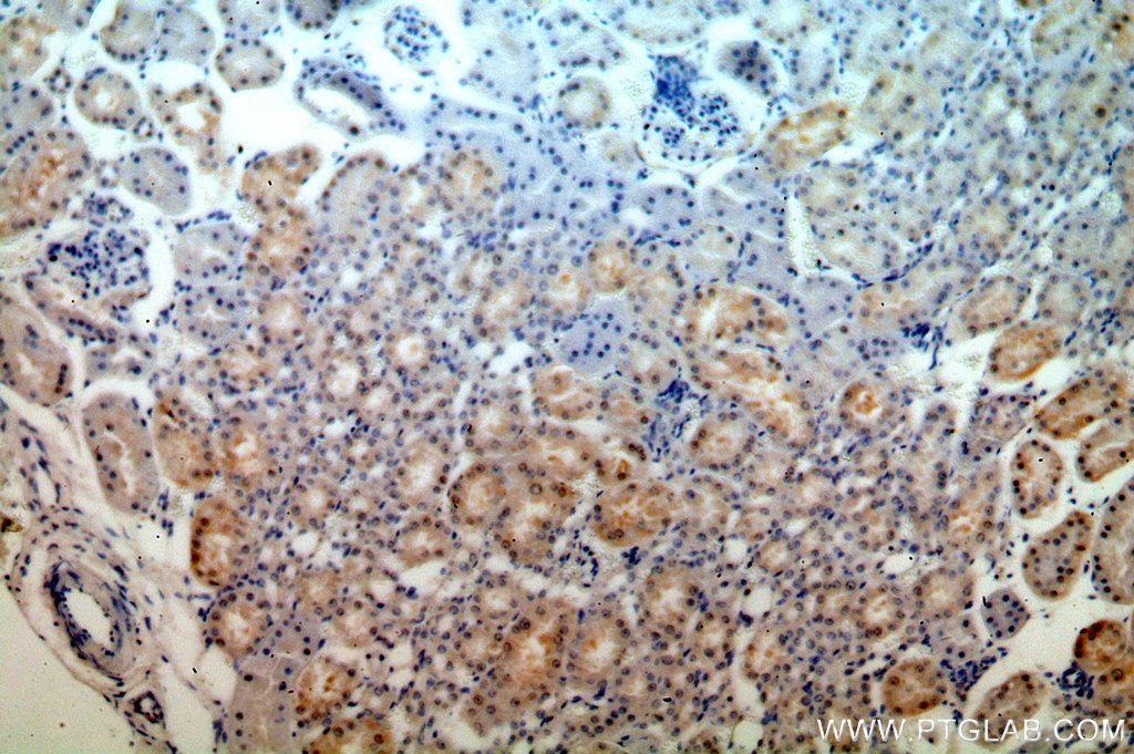 IHC staining of human kidney using 19507-1-AP